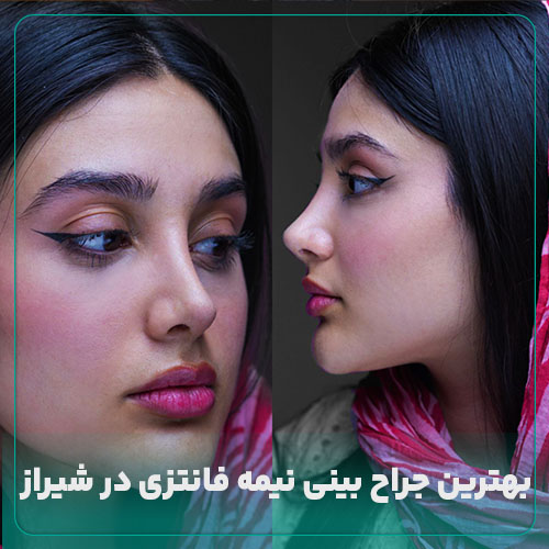 بهترین جراح نیمه فانتزی