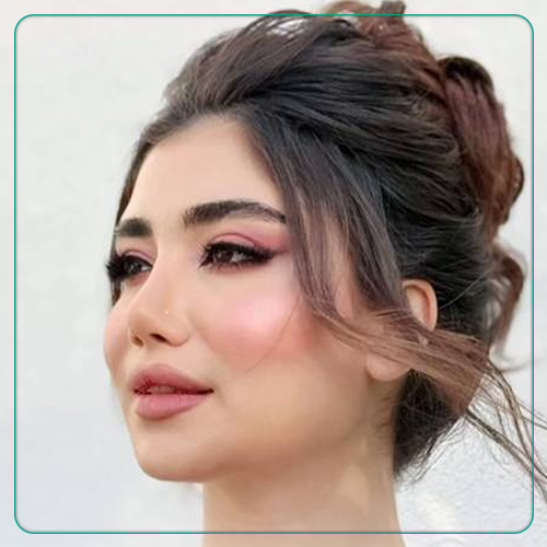 نمونه عمل بینی دکتر شهریار شاهمرادی در شیراز