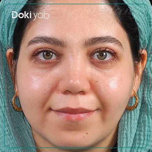 نمونه عمل بینی دکتر علی جاودانی در تهران