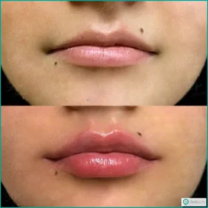 عکس ژل لب مدل صدفی