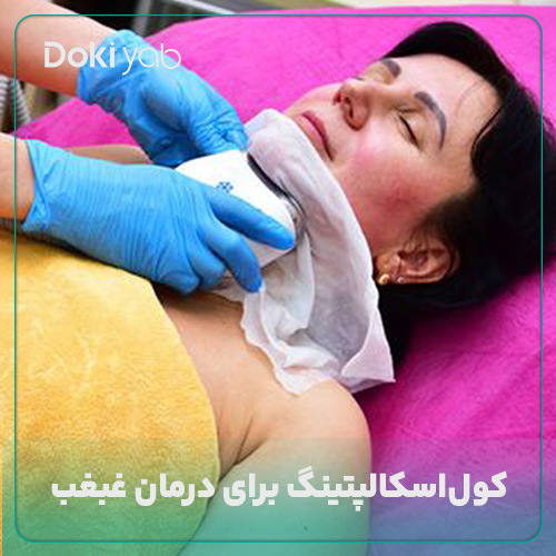 کولاسکالپتینگ برای درمان غبغب