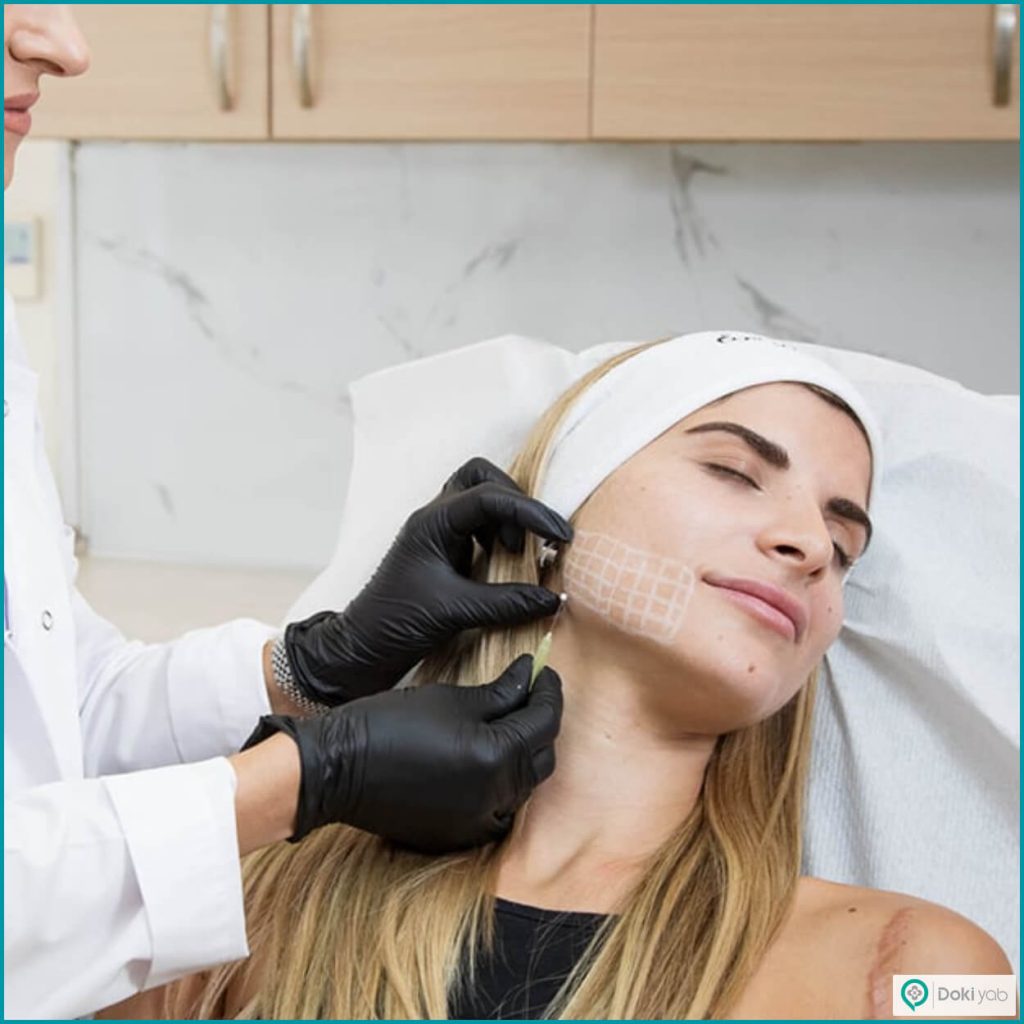 تاثیر ناحیه موردنظر در تعیین قیمت لیفت صورت با نخ در شیراز