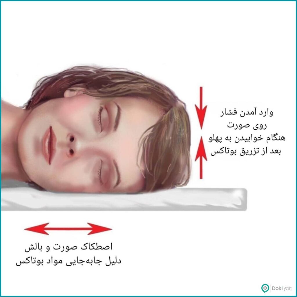 به پهلو خوابیدن بعد از تزریق بوتاکس، دلیل جابه‌جایی مواد در صورت