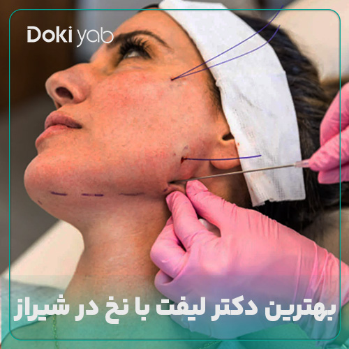معرفی بهترین دکتر لیفت صورت با نخ در شیراز