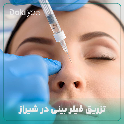 همه چی چیز درباره تزریق فیلر بینی در شیراز در دکی یاب