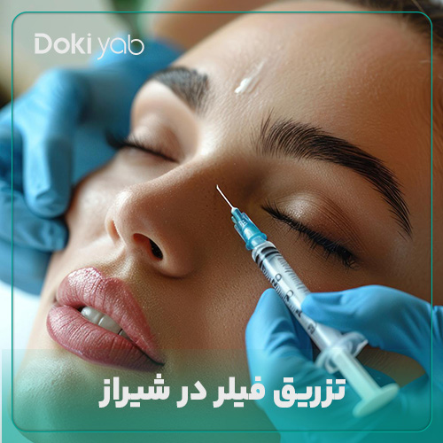 همه چیز درباره تزریق فیلر در شیراز در دکی یاب