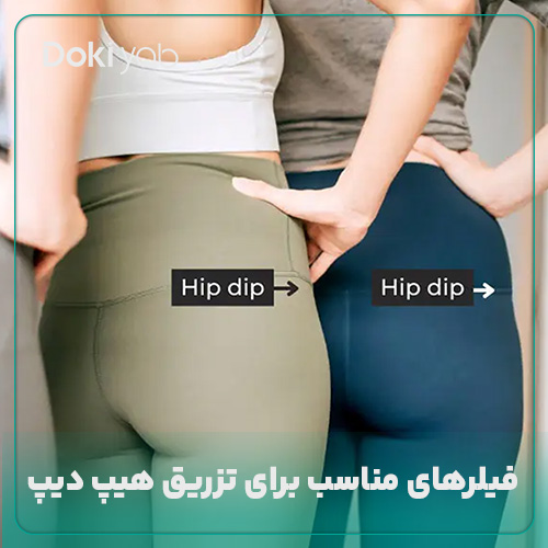 بررسی ویژگی فیلرهای مورداستفاده برای تزریق هیپ‌ دیپ در شیراز