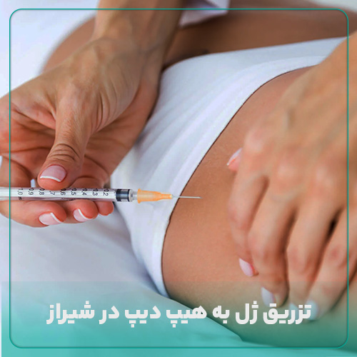 همه چیز درباره تزریق ژل به هیپ دیپ در شیراز در دکی یاب