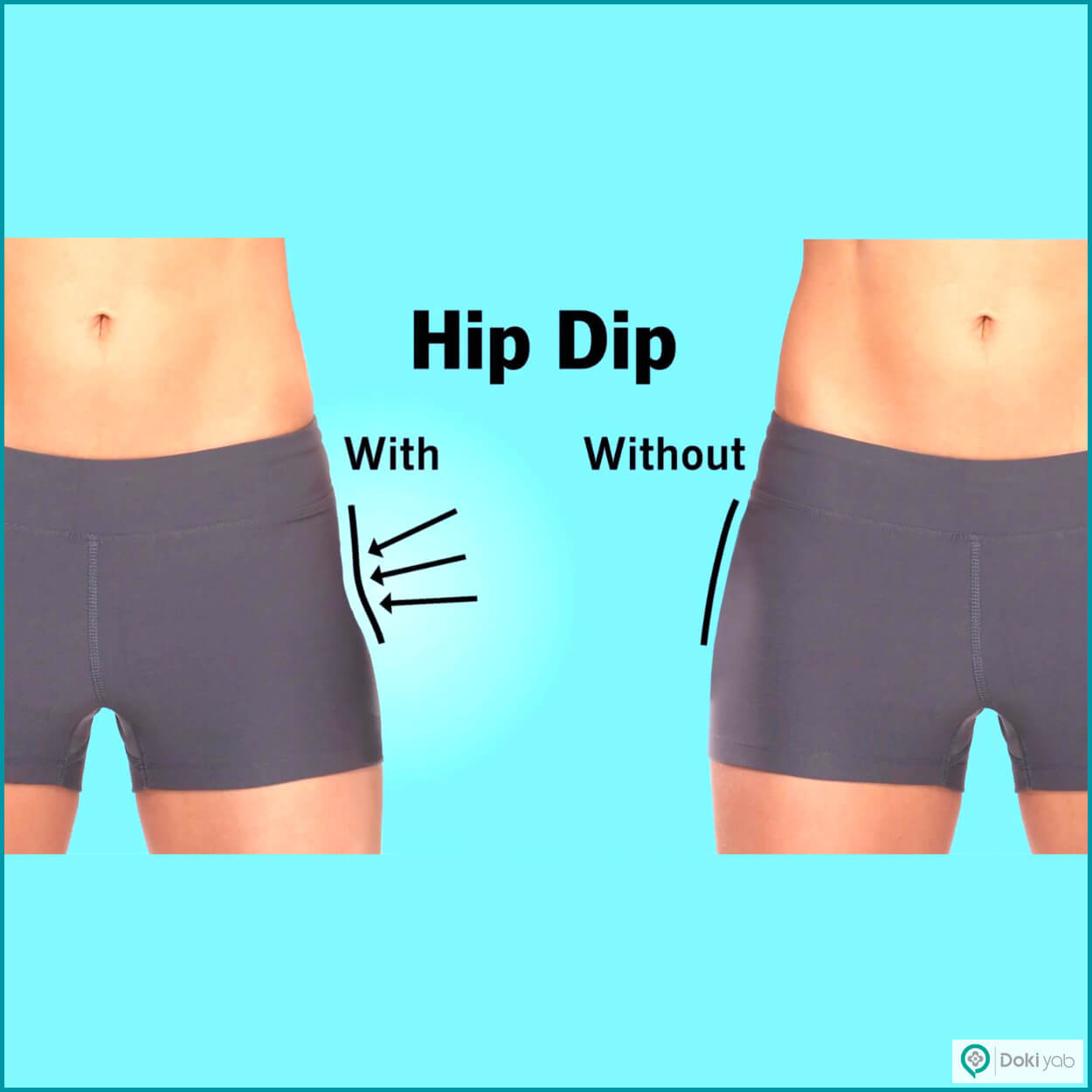 تزریق ژل به هیپ دیپ در شیراز در مجموعه دکی یاب