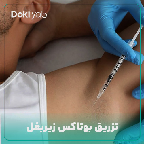 تزریق بوتاکس زیربغل در شیراز در دکی یاب