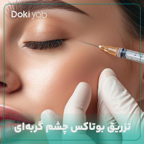 بررسی تزریق بوتاکس چشم گربه‌ای در شیراز در دکی یاب