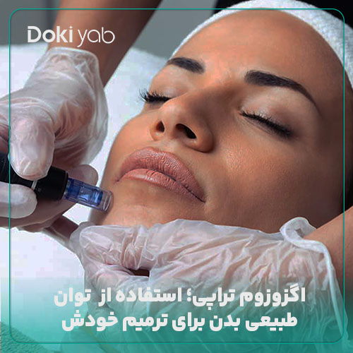اگزوزوم تراپی برای درمان طبیعی پوست در دکی یاب