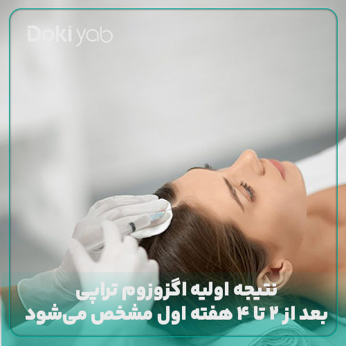 زمان مشخص شدن نتیجه نهایی اگزوزوزم تراپی در دکی یاب