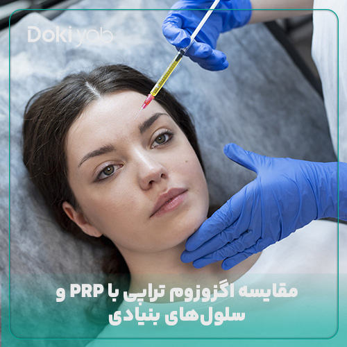 مقایسه اگزوزوم تراپی با PRP و سلولدرمانی با سلولهای بنیادی