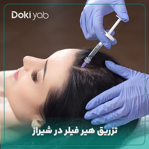 همه چیز درباره تزریق هیر فیلر در شیراز در دکی یاب