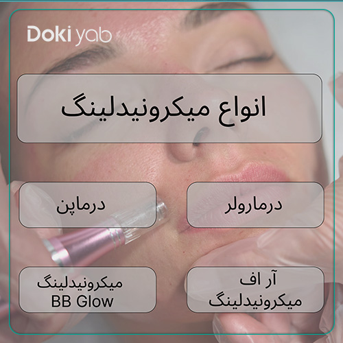 انواع روشهای میکرونیدلینگ در شیراز