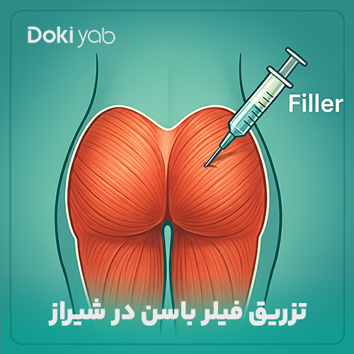 همه چیز درباره تزریق فیلر باسن در شیراز
