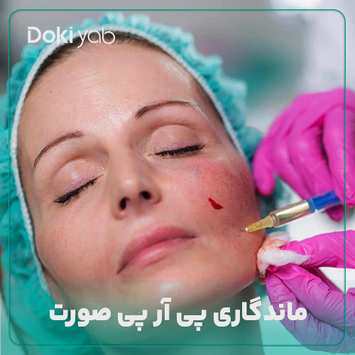 بررسی ماندگاری پی ار پی صورت در دکی یاب