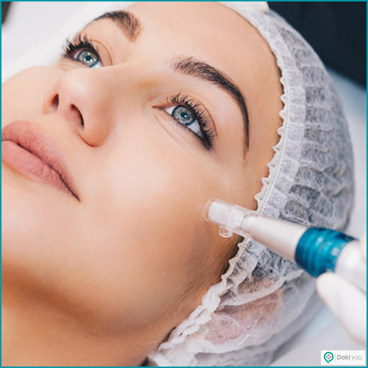 میکرونیدلینگ با دستگاه درماپن