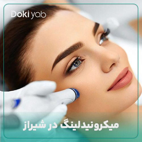 همه چیز درباره میکرونیدلینگ شیراز در دکی یاب