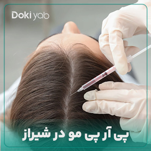 همه چیز درباره پی آر پی مو در شیراز در دکی یاب