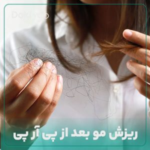 علت ریزش مو بعد از پی ار پی چیست؟ آیا پی آر پی باعث ریزش مو میشود؟