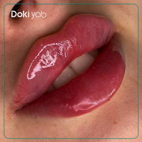عکس ژل لب روسی در دکی یاب