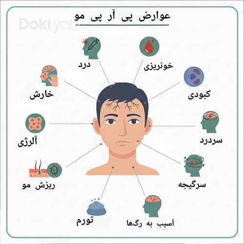 بررسی عوارض پی آر پی مو