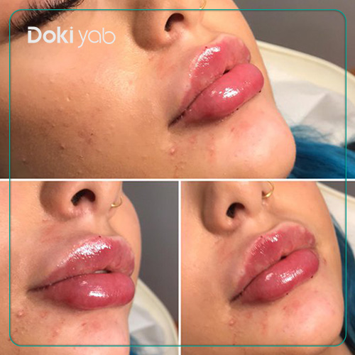 ماندگاری ژل لب قلوه ای