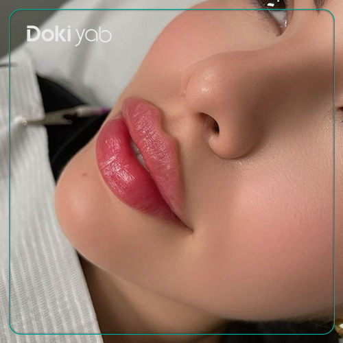 عکس ژل لب قلوهای