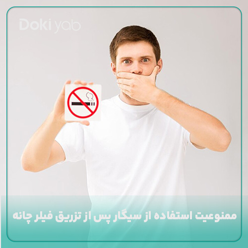 ممنوعیت استفاده از سیگار پس از تزریق فیلر چانه