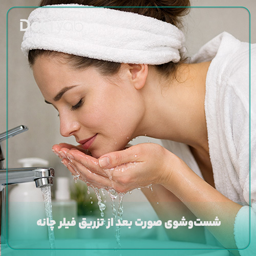 شست‌وشوی صورت بعد از تزریق فیلر چانه
