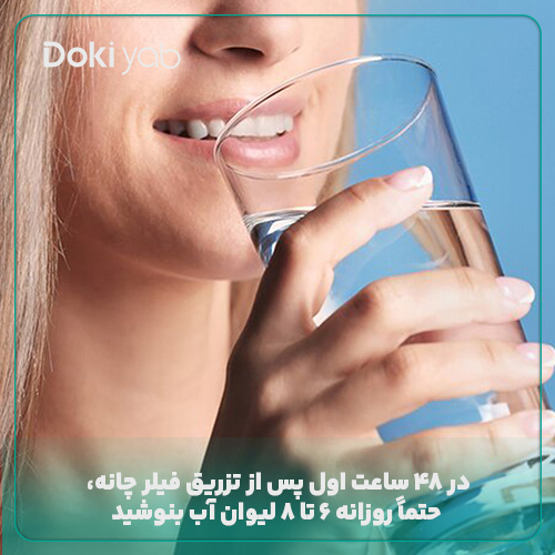 نوشیدن 6 تا 8 لیوان آب پس از تزریق فیلر چانه