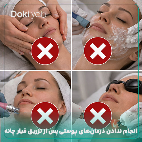  انجام ندادن درمان‌های پوستی پس از تزریق فیلر چانه 