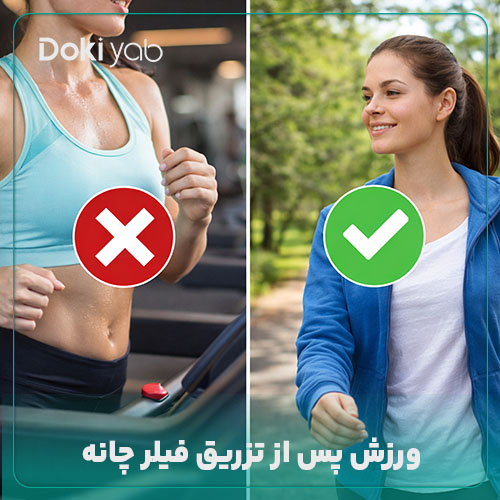 ورزش پس از تزریق فیلر چانه