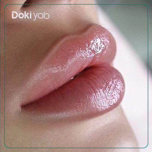 عکس نمونه تزریق فیلر لب مدل قلبی