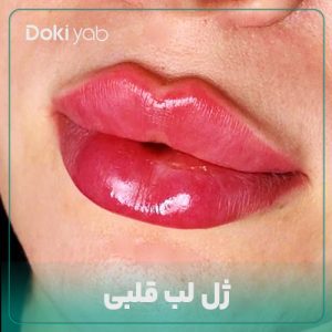 ژل لب قلبی چیست؟ عکس‌ ژل لب مدل قلبی + هزینه
