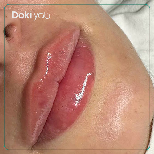 عکس مدل لب قلبی