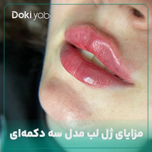 مزایای ژل لب مدل سه دکمه‌ای 