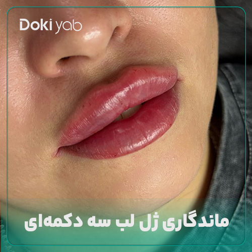 ماندگاری ژل لب سه دکمه ‌ای 