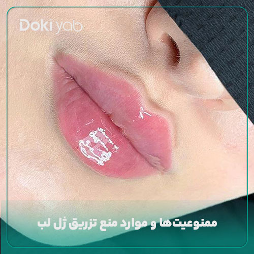 بررسی موارد منع تزریق ژل لب