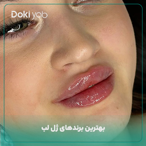 معرفی بهترین برندها برای تزریق ژل لب 
