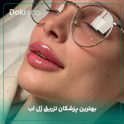 معرفی بهترین پزشکان تزریق ژل لب