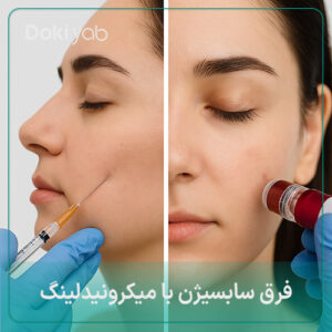فرق سابسیژن با میکرونیدلینگ چیست؟ سابسیژن بهتر است یا میکرونیدلینگ؟