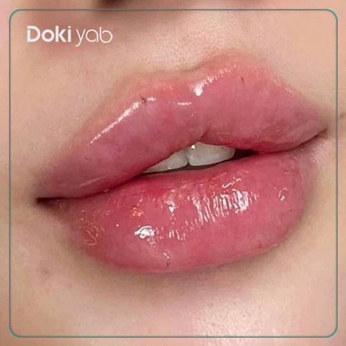 نمونه ژل لب قلبی