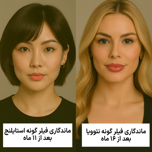 مقایسه ماندگاری فیلر گئونه استایلنج و نئوویا