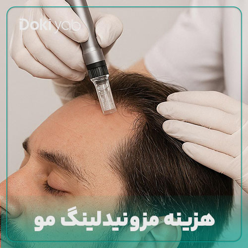 بررسی هزینه مزونیدلینگ مو