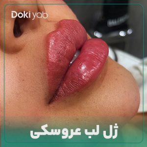 ژل لب عروسکی مجله دکی یاب