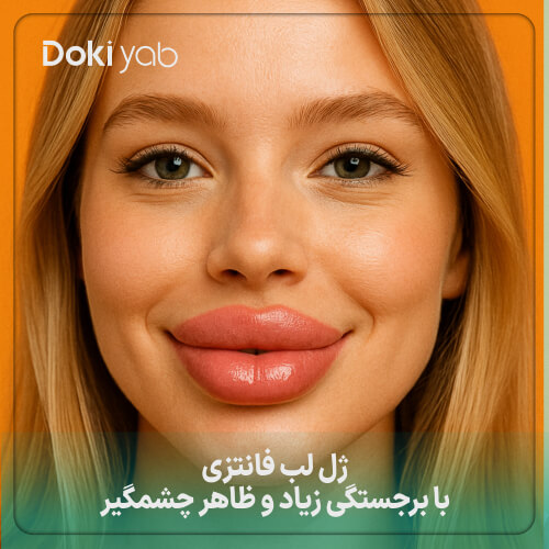 ژل لب فانتزی با برجستگی زیاد و ظاهر چشمگیر