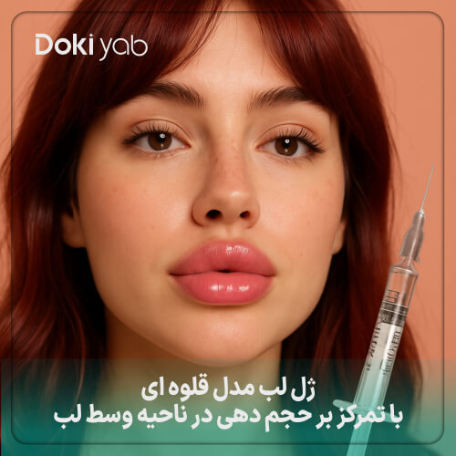 ژل لب مدل قلوه ای با تمرکز بر حجم دهی در ناحیه وسط لب 